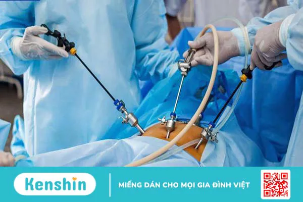 Chuẩn bị gì trước khi phẫu thuật nội soi tim - Bạn đã biết hay chưa? 4