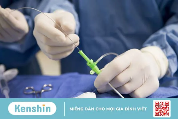 Chăm sóc bệnh nhân sau khi đặt ống thông tim như thế nào? 1