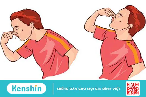 Nghiêng người về phía trước khi bị chảy máu mũi