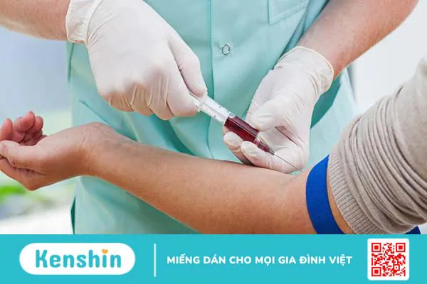 Giải đáp thắc mắc: Chỉ số Baso trong xét nghiệm máu là gì?