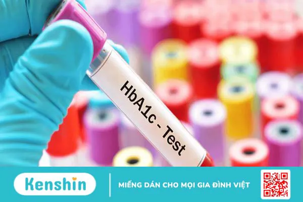 Chỉ số HbA1c bình thường là bao nhiêu? Khi nào nên làm xét nghiệm HbA1C?