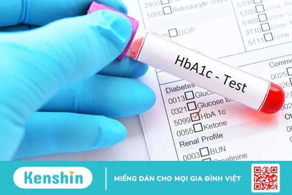 Chỉ số HbA1c bình thường là bao nhiêu? Khi nào nên làm xét nghiệm HbA1C?