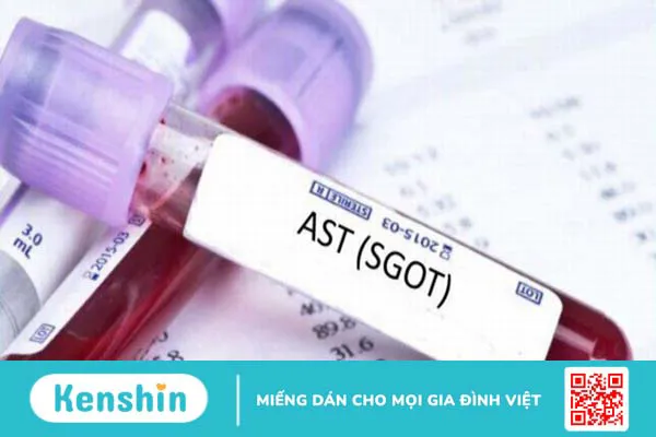 Chỉ số xét nghiệm SGOT là gì? Khi nào cần xét nghiệm SGOT?