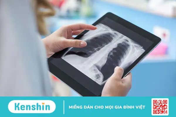 Chi tiết quy trình chụp X quang tràn khí màng phổi 3