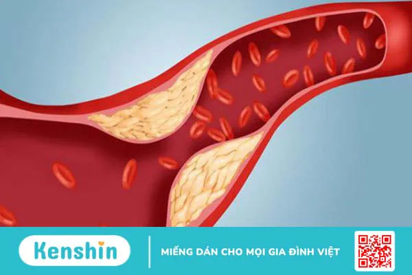 Cholesterol là gì? Kiểm soát cholesterol trong máu thế nào? 2