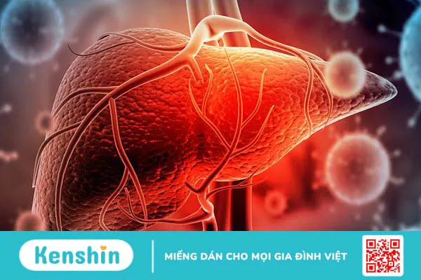 Chữa viêm gan C bằng thuốc nam có thực sự hiệu quả như lời đồn 1