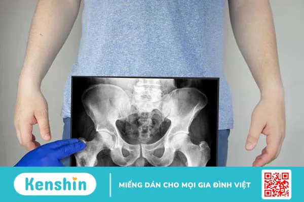 Chụp X quang khung chậu có ý nghĩa gì? Quy trình thực hiện ra sao 1