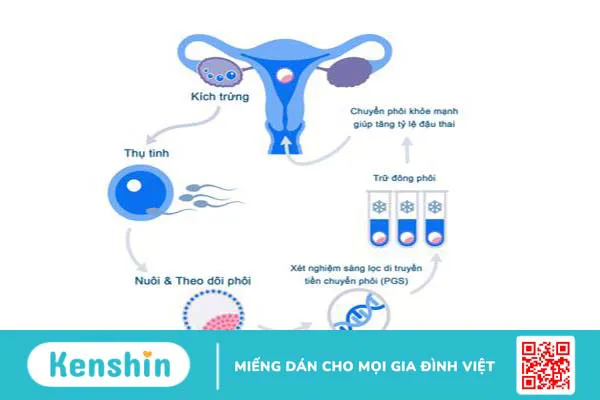 Chuyển phôi là gì? Quy trình chuyển phôi vào tử cung trong IFV 3