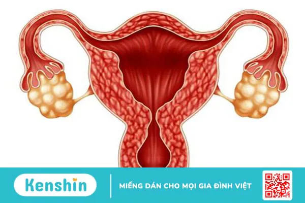 Có kinh sớm 1 tuần có sao không? 2