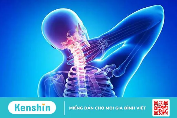 Đau buốt cơ ở cổ dưới gáy do nguyên nhân gì? Cách điều trị và phòng ngừa 2