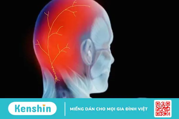 Đau đầu sau tai: Nguyên nhân và cách điều trị dứt điểm 1