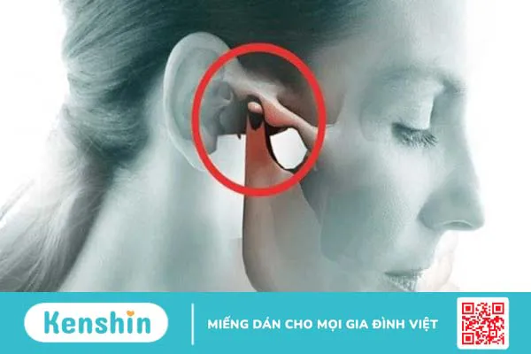 Đau đầu sau tai: Nguyên nhân và cách điều trị dứt điểm 3