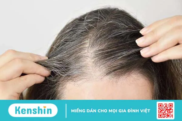 Đau đầu với những bệnh thường gặp ở tóc 2