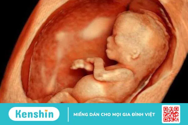 Dấu hiệu thai lưu 7 tuần là gì? Những thông tin cần biết 1