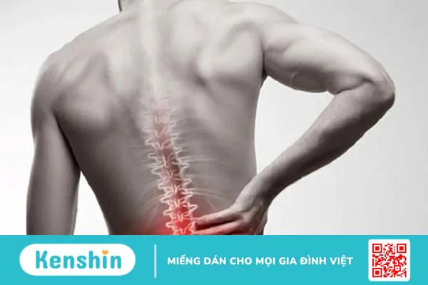 Đau lưng kiểu viêm là bệnh gì và nó có liên quan đến viêm cột sống dính khớp? 1