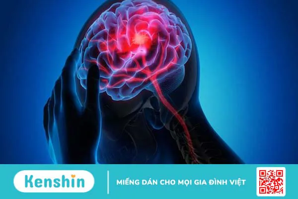 Đau nửa đầu khám ở đâu tốt nhất tại TP.HCM và nên khám ở chuyên khoa nào? 1