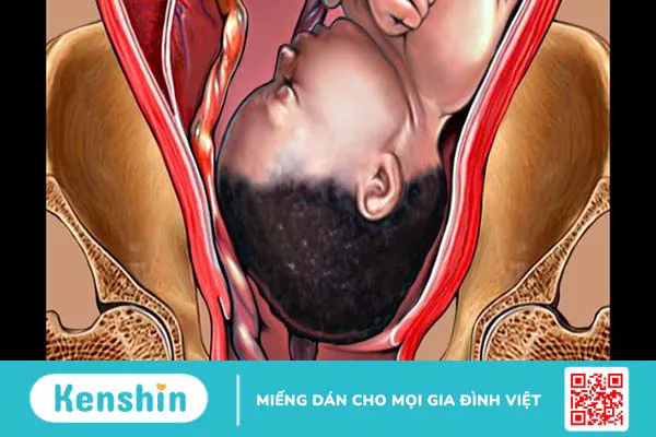 Dây rốn có chức năng gì? Cách chăm sóc dây rốn đúng cách cho trẻ sơ sinh 2