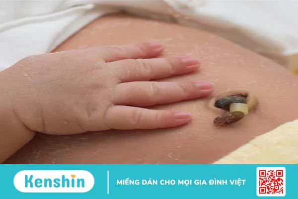 Dây rốn có chức năng gì? Cách chăm sóc dây rốn đúng cách cho trẻ sơ sinh 4