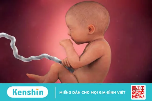 Dây rốn một động mạch là như thế nào? Nguyên nhân do đâu? 1