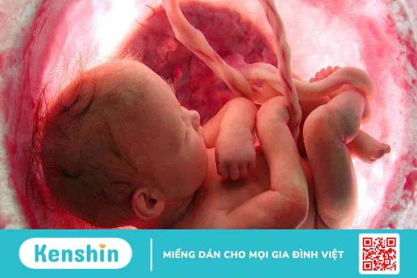 Dây rốn quấn cổ 1 vòng tuần 38 có nguy hiểm cho mẹ và bé hay không? 2