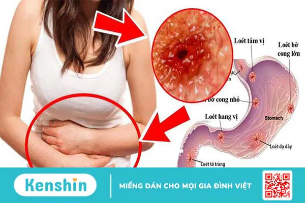 Dây thần kinh số 10 là gì? Các vấn đề liên quan đến dây thần kinh số 10 2