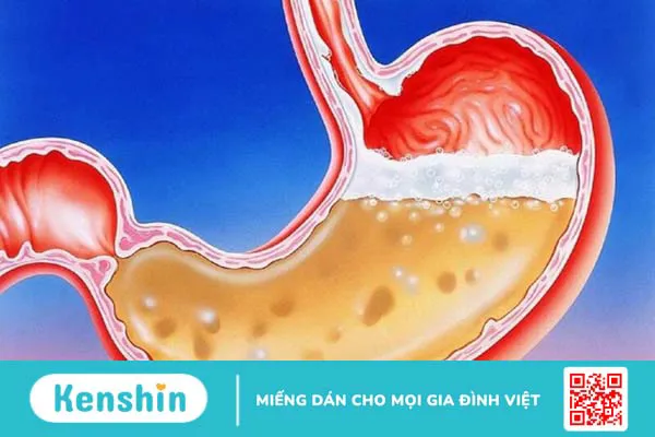 Dịch vị là gì? Cơ chế điều hòa tiết dịch vị của dạ dày 1