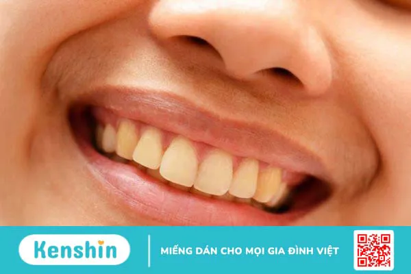 Điểm mặt 8 thói quen sai lầm khiến răng bị ố vàng mà bạn nên biết 2