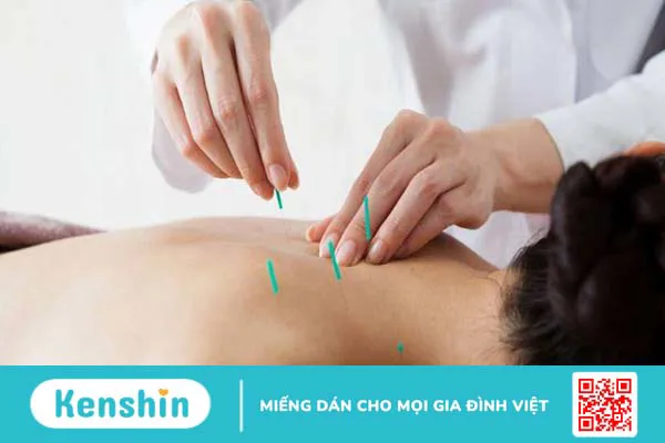 Điện châm chữa đau vai gáy có hiệu quả không? Các bước tiến hành kỹ thuật điện châm 3