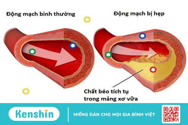 Điện tâm đồ gắng sức 03