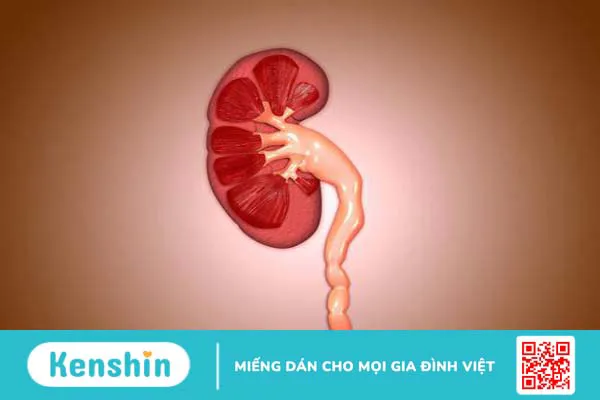 Điều trị bệnh hẹp niệu quản thận ứ nước như thế nào?  01