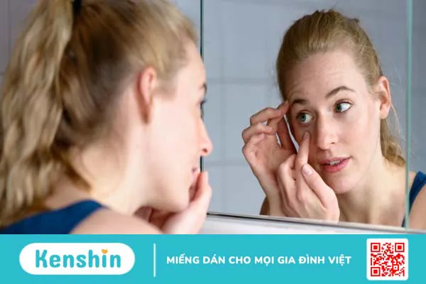 Điều trị và phòng tránh mắt bị lông quặm hiệu quả 4