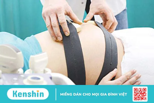 Đo Non-stress test bao nhiêu tiền? Quy trình từng bước đo Non-stress test 4