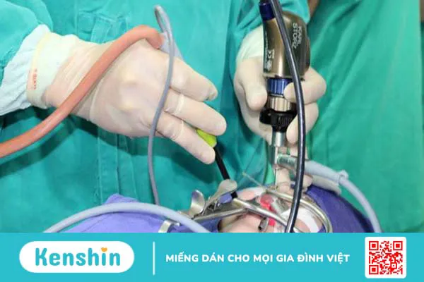 Đốt cuốn mũi bằng sóng cao tần: Khái niệm, phương pháp, đối tượng và lưu ý 1