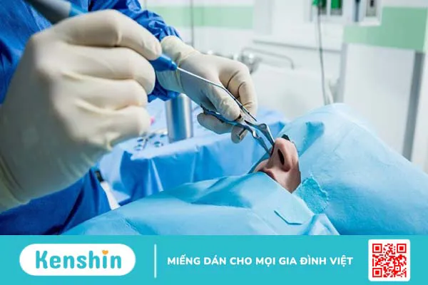 Đốt cuốn mũi bằng sóng cao tần: Khái niệm, phương pháp, đối tượng và lưu ý 2