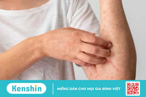 Dùng các loại rễ cây ngâm rượu: Lợi hay hại? 3