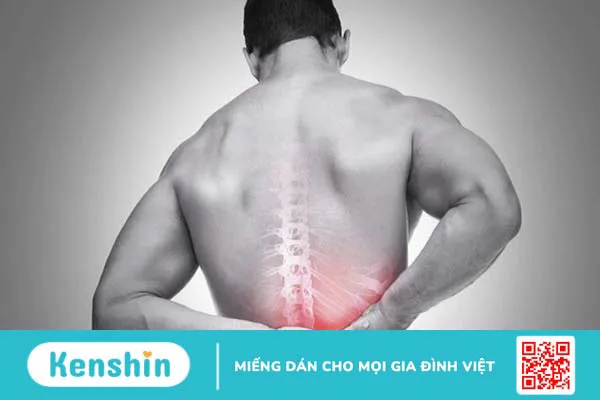 Đừng nhầm lẫn giữa u cột sống với thoát vị đĩa đệm 1