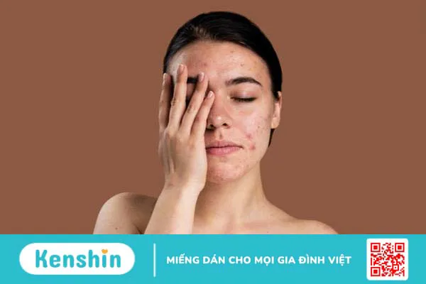 Dùng xịt khoáng trước hay sau serum mới đúng quy trình? 4