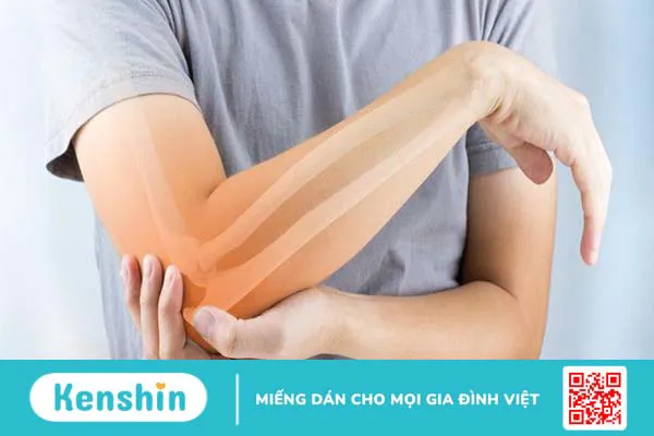 Gãy mỏm khuỷu đơn độc có triệu chứng gì? Cách điều trị ra sao? 1