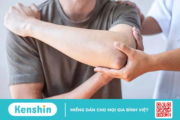 Gãy mỏm khuỷu đơn độc có triệu chứng gì? Cách điều trị ra sao? 2