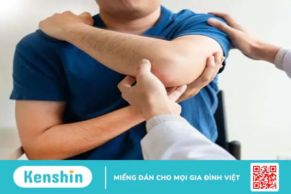 Gãy mỏm khuỷu đơn độc có triệu chứng gì? Cách điều trị ra sao? 3