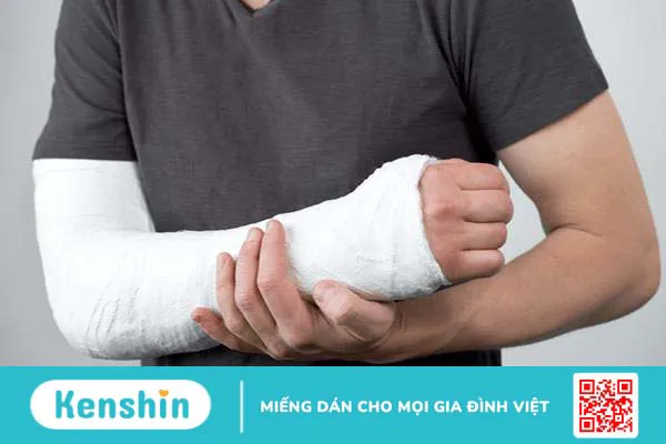 Gãy mỏm khuỷu đơn độc có triệu chứng gì? Cách điều trị ra sao? 4