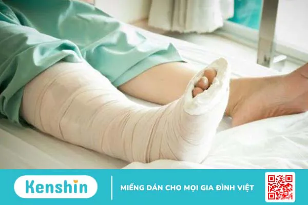 Gãy sụn tăng trưởng ở trẻ em: Nguyên nhân, triệu chứng, chẩn đoán, điều trị 4