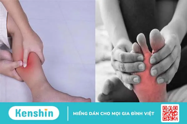 Giải đáp: Bị chuột rút có phải thiếu canxi không? 1