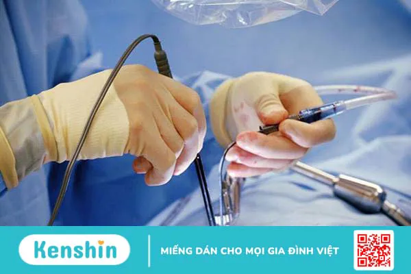 Giải đáp thắc mắc khi chọn phẫu thuật nội soi tim 1