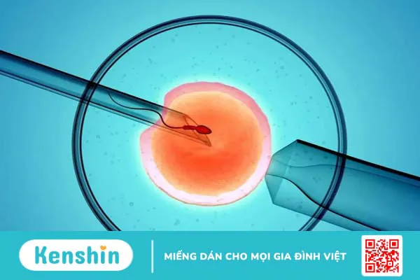 Giải đáp những thủ tục làm IVF cho người nước ngoài tại Việt Nam 4