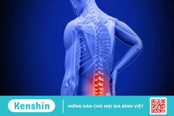 Giải đáp tất tần tật về vấn đề vôi hóa xương 2