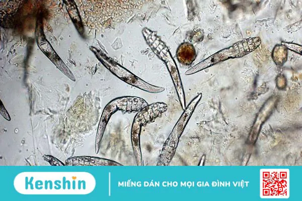 [Giải đáp thắc mắc] Ghẻ Demodex ở chó có lây sang người không? 1