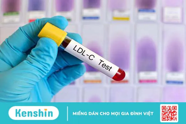 Giải đáp thắc mắc: Xét nghiệm cholesterol toàn phần là gì? 1