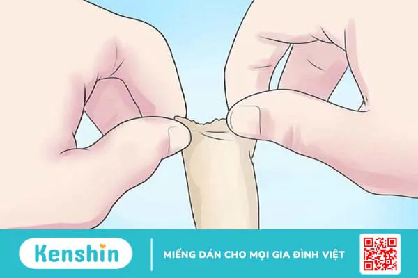 Giải thích chi tiết: 30 tuổi có nên cắt bao quy đầu không? 1