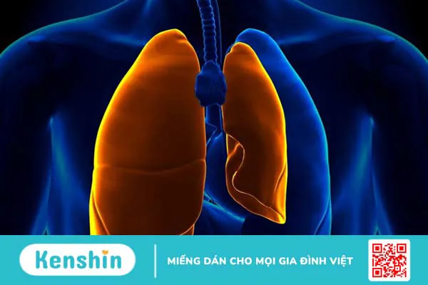 Giãn phế nang: Nguyên nhân, triệu chứng, chẩn  3đoán và điều trị